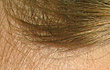  Elecom ,  Ear Drops ,   